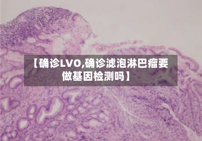 【确诊LVO,确诊滤泡淋巴瘤要做基因检测吗】