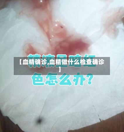 【血精确诊,血精做什么检查确诊】
