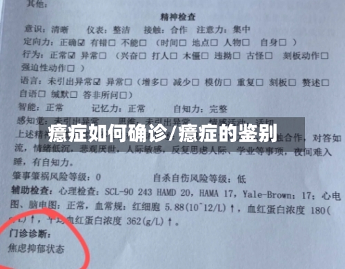 癔症如何确诊/癔症的鉴别-第2张图片