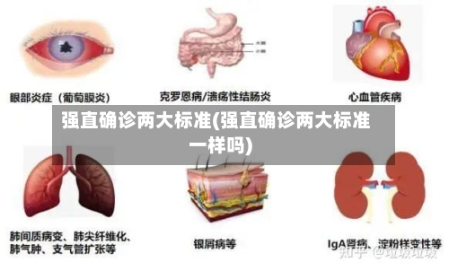 强直确诊两大标准(强直确诊两大标准一样吗)-第2张图片