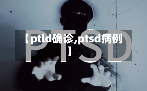 【ptld确诊,ptsd病例】-第2张图片