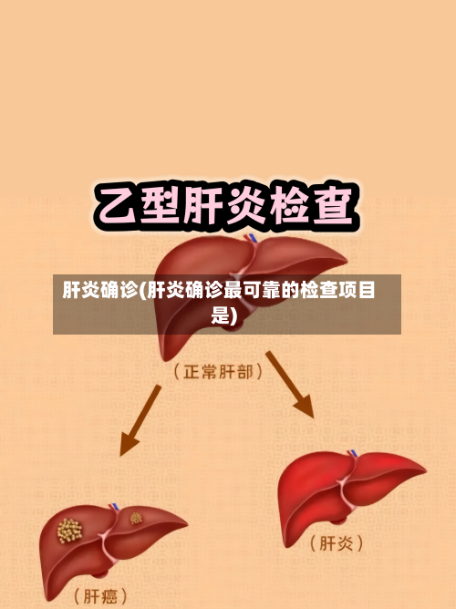 肝炎确诊(肝炎确诊最可靠的检查项目是)
