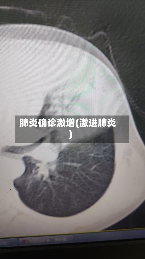 肺炎确诊激增(激进肺炎)