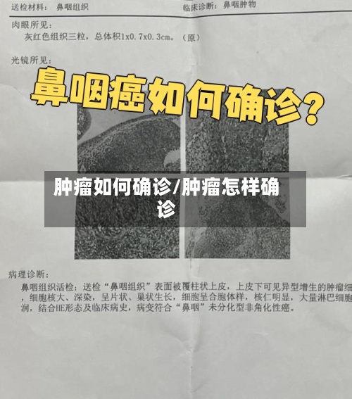 肿瘤如何确诊/肿瘤怎样确诊