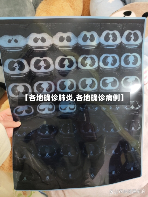 【各地确诊肺炎,各地确诊病例】-第2张图片