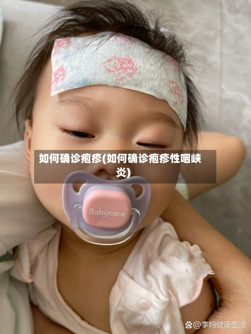 如何确诊疱疹(如何确诊疱疹性咽峡炎)-第2张图片