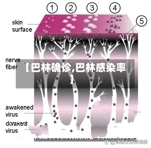【巴林确诊,巴林感染率】-第3张图片