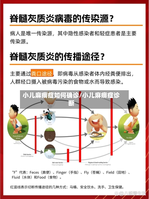 小儿麻痹症如何确诊/小儿麻痹症诊断