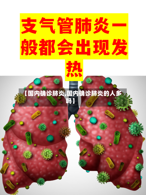 【国内确诊肺炎,国内确诊肺炎的人多吗】-第3张图片