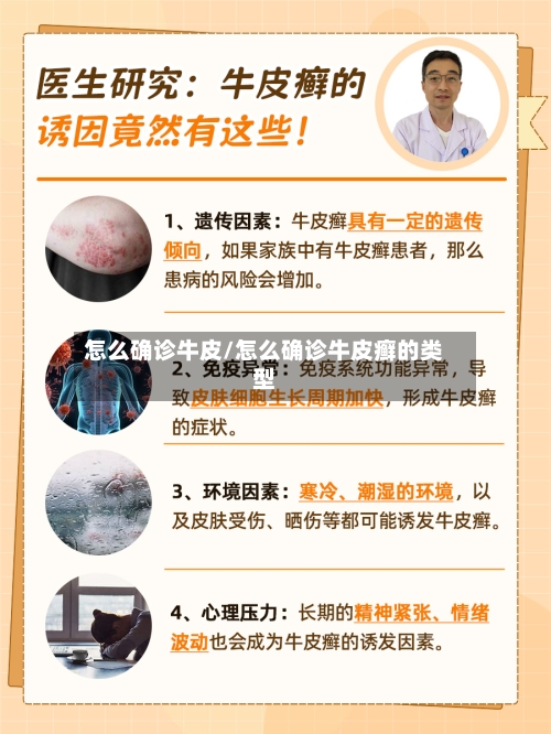 怎么确诊牛皮/怎么确诊牛皮癣的类型