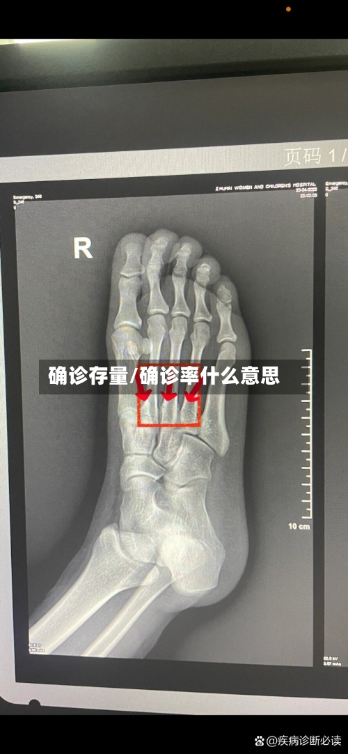 确诊存量/确诊率什么意思