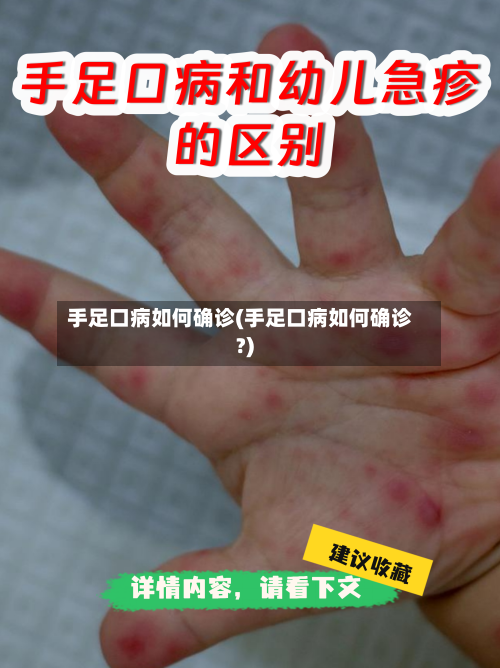 手足口病如何确诊(手足口病如何确诊?)