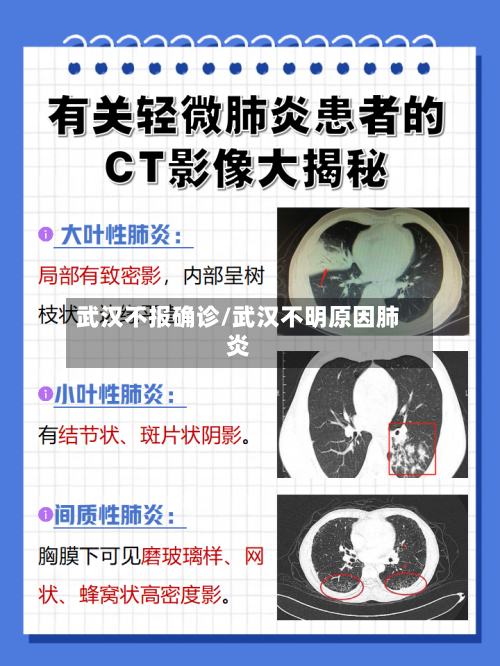 武汉不报确诊/武汉不明原因肺炎