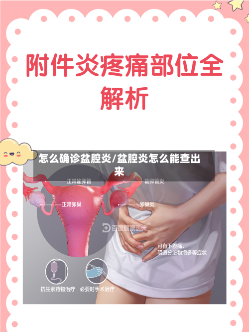 怎么确诊盆腔炎/盆腔炎怎么能查出来-第2张图片