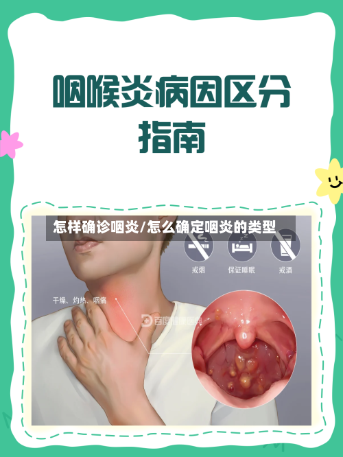 怎样确诊咽炎/怎么确定咽炎的类型-第2张图片