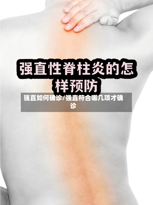 强直如何确诊/强直符合哪几项才确诊